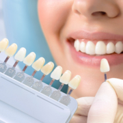 Un dentiste compare différentes teintes de facettes dentaires à un sourire éclatant pour sélectionner la meilleure correspondance.
