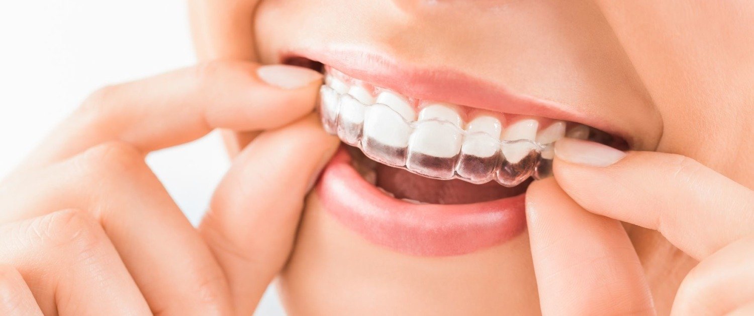 Beautiful smile and white teeth of a young woman.